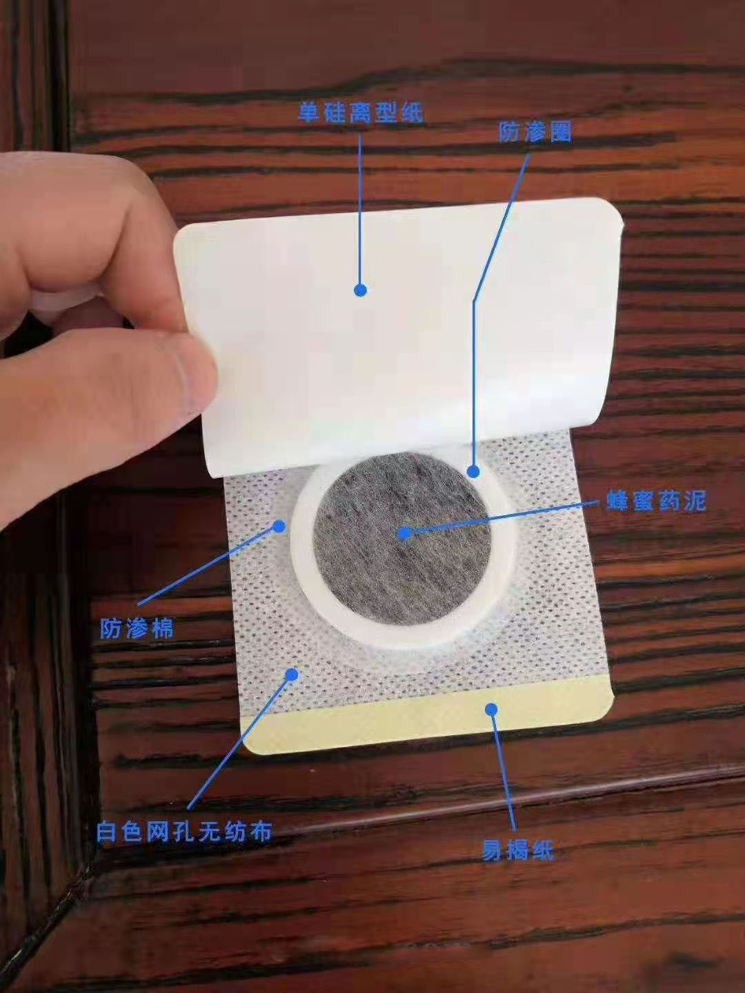 穴位壓力刺激貼。